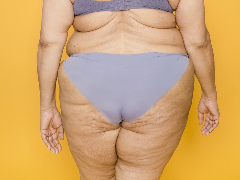 Back view of anonymous overweight woman in underwear with cellulite on thighs and skin folds on back