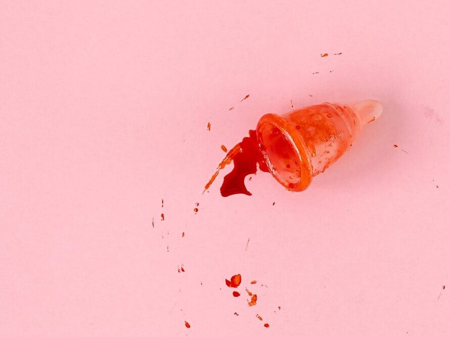 Brown and White Butterfly on Pink Surface