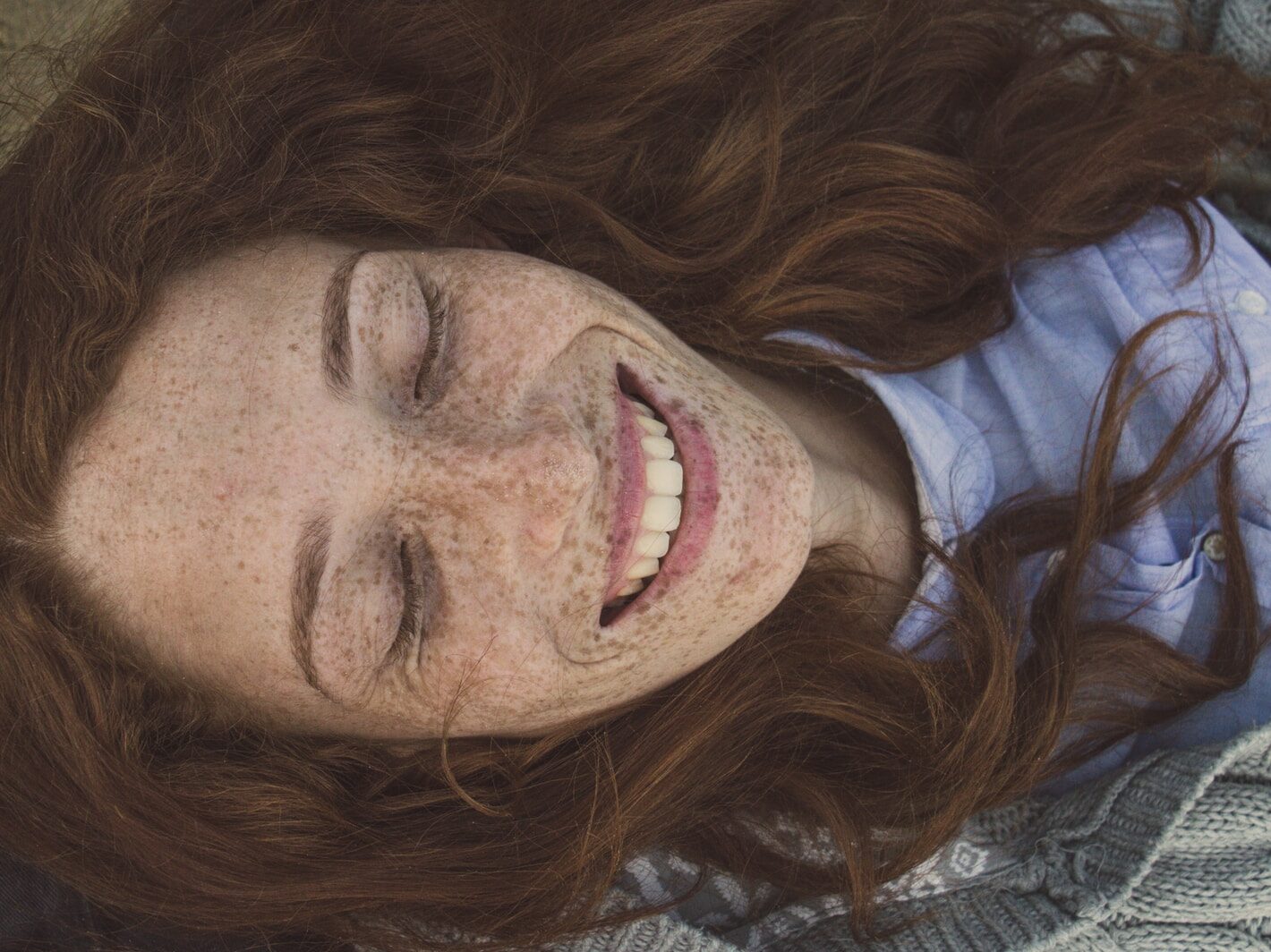 woman's face with freckles