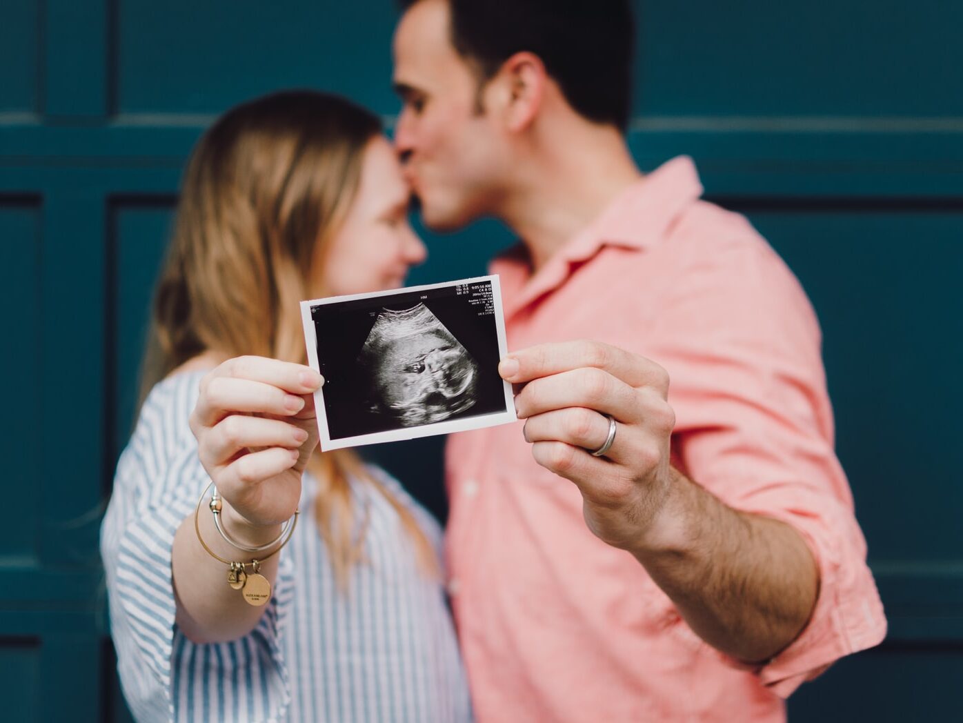 man kissing woman's forehead white holding ultrasound photo