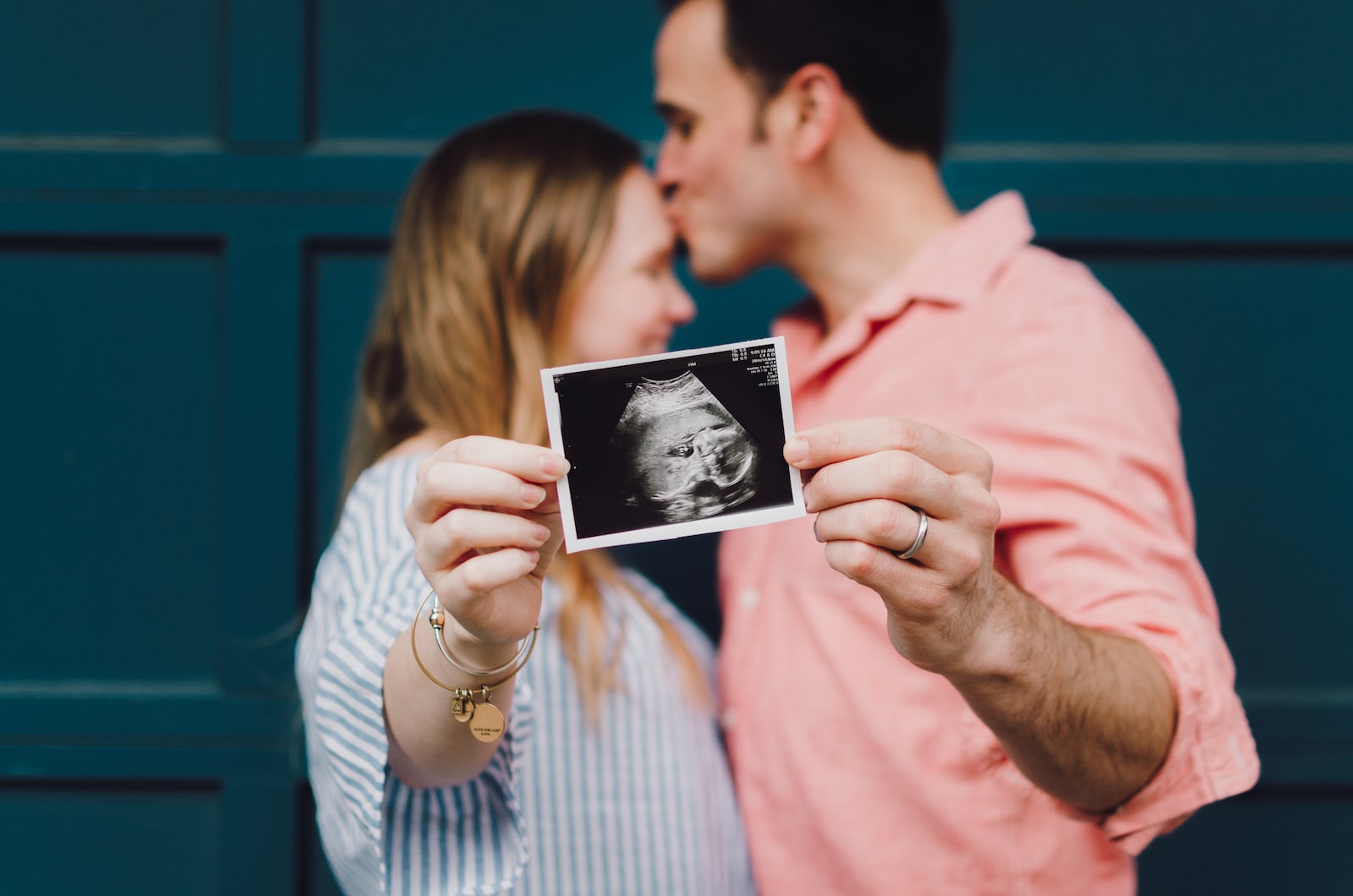 - ČasProŽeny.cz man kissing woman's forehead white holding ultrasound photo