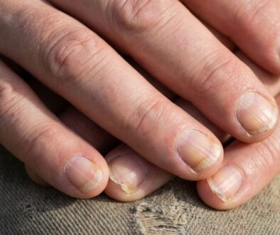 co-o-va-em-zdrav-prozrad-va-e-nehty-sledujte-ty-featured